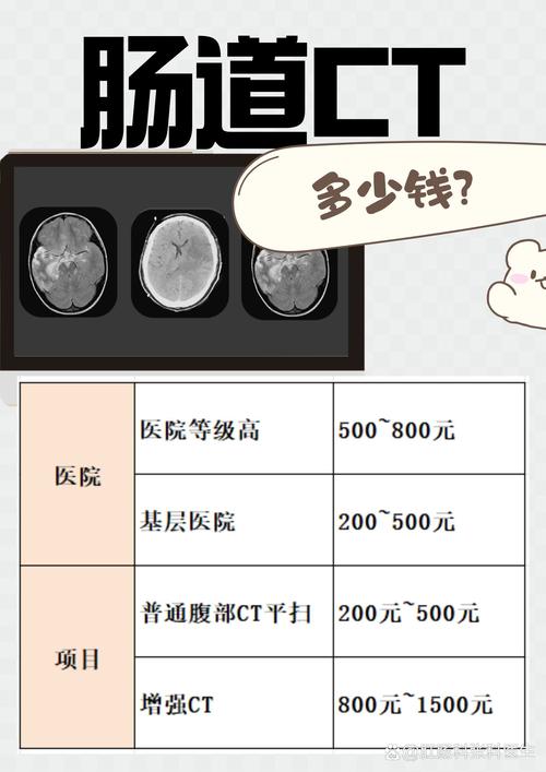 胃部ct多少钱做一次(胃能做ct检查吗)